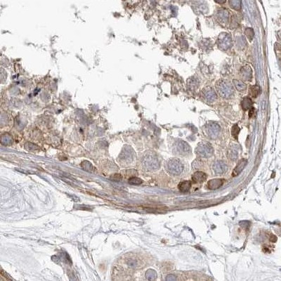 NUP43 Antibody in Immunohistochemistry (IHC)