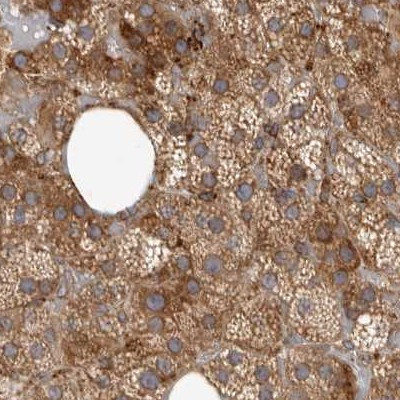 NUP43 Antibody in Immunohistochemistry (IHC)