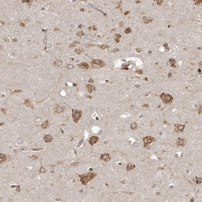 NUP43 Antibody in Immunohistochemistry (IHC)