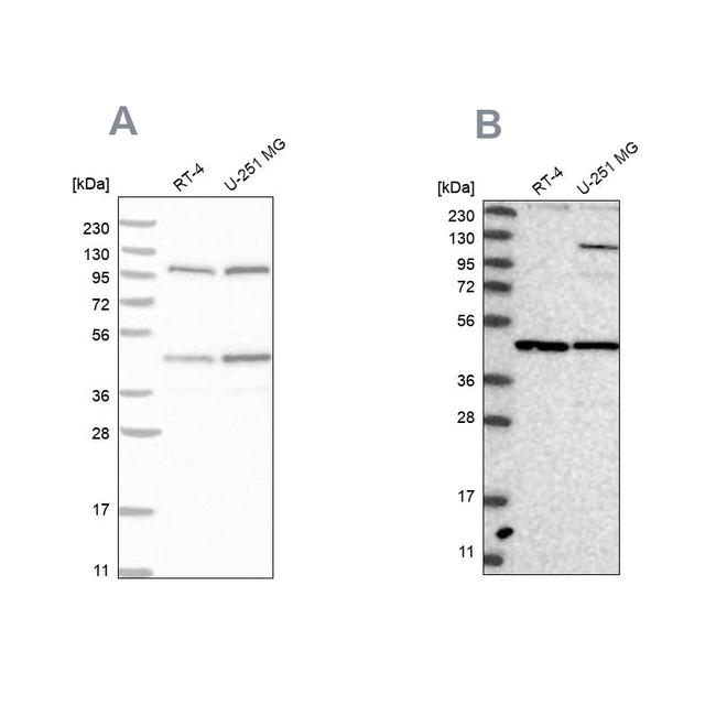 NUP43 Antibody in Western Blot (WB)