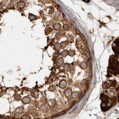 CAMSAP2 Antibody in Immunohistochemistry (IHC)