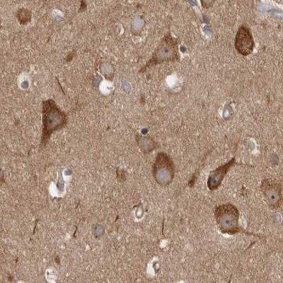 CAMSAP2 Antibody in Immunohistochemistry (IHC)