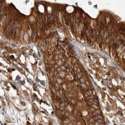 CAMSAP2 Antibody in Immunohistochemistry (IHC)