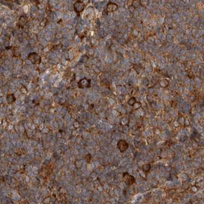 CAMSAP2 Antibody in Immunohistochemistry (IHC)