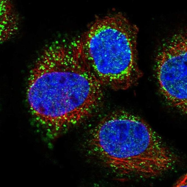 SCP2 Antibody in Immunocytochemistry (ICC/IF)