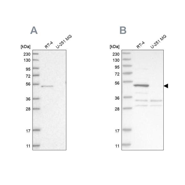 SCP2 Antibody in Western Blot (WB)