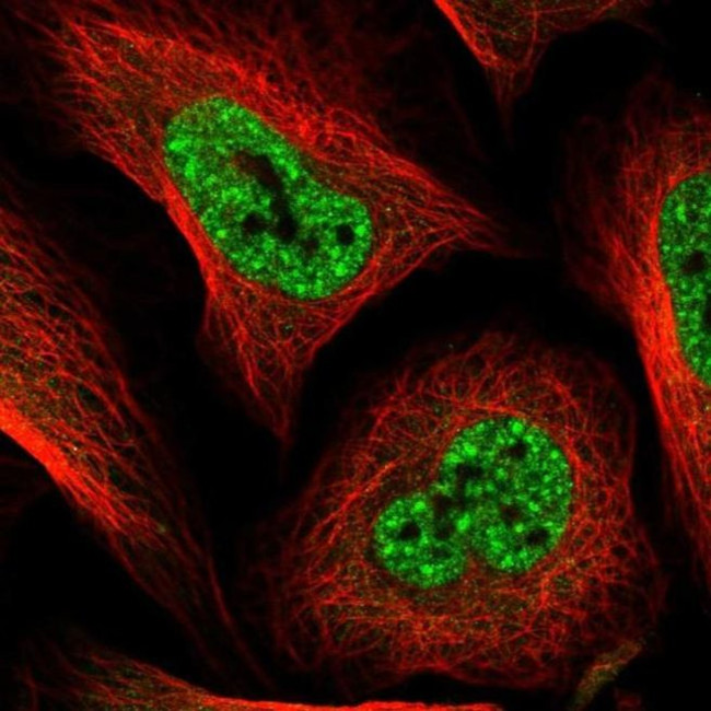 S100PBP Antibody in Immunocytochemistry (ICC/IF)