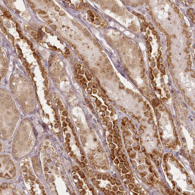 CHCHD2 Antibody in Immunohistochemistry (IHC)