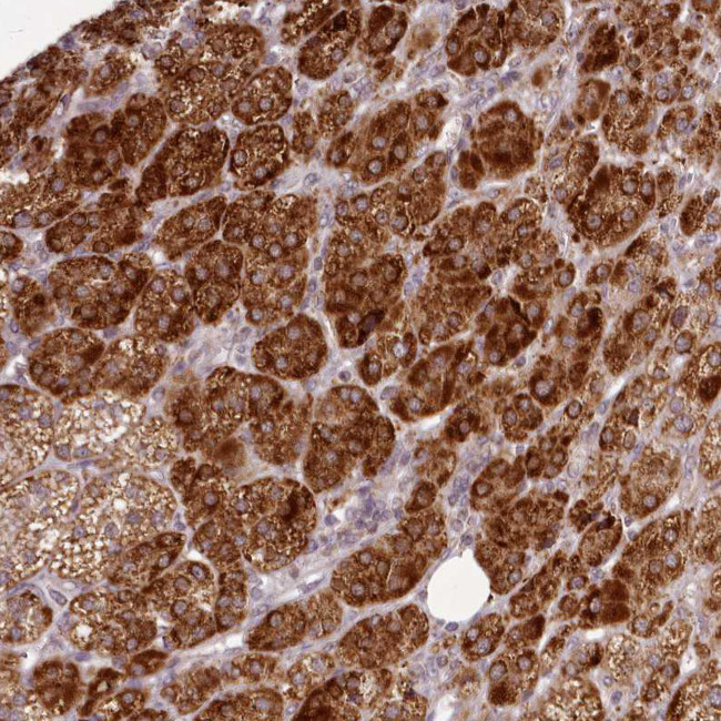 CHCHD2 Antibody in Immunohistochemistry (IHC)