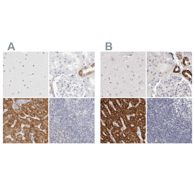 HMGCS2 Antibody in Immunohistochemistry (IHC)