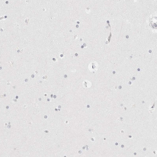 HMGCS2 Antibody in Immunohistochemistry (IHC)