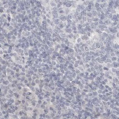 HMGCS2 Antibody in Immunohistochemistry (IHC)