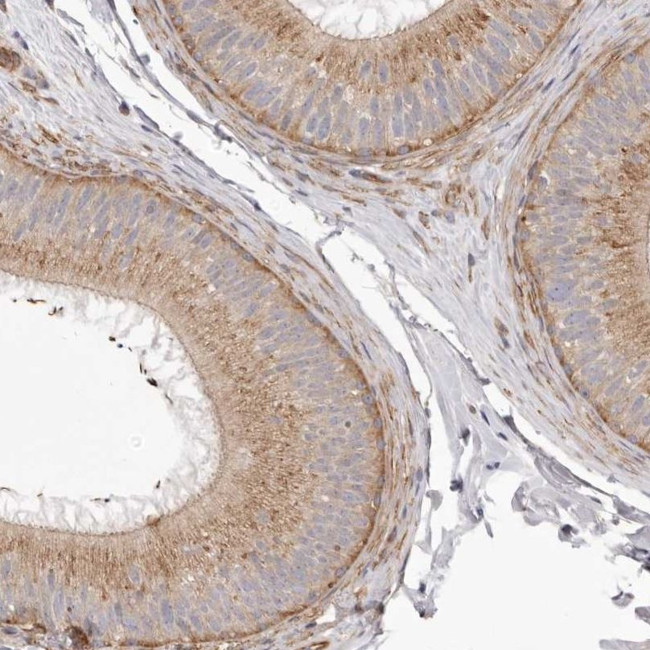 VPS45 Antibody in Immunohistochemistry (IHC)