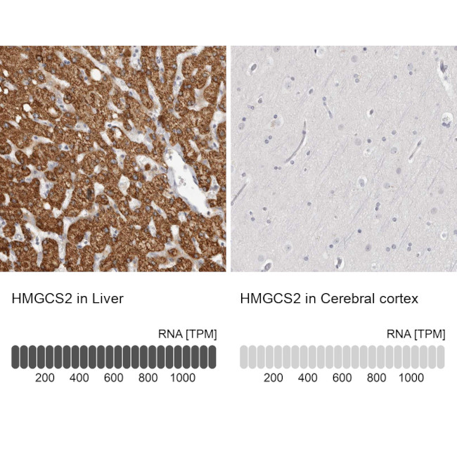 HMGCS2 Antibody