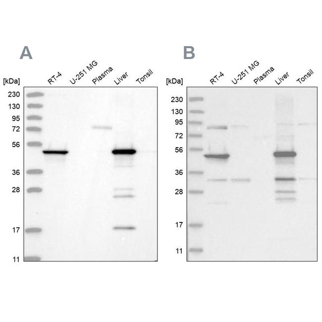 HMGCS2 Antibody in Western Blot (WB)