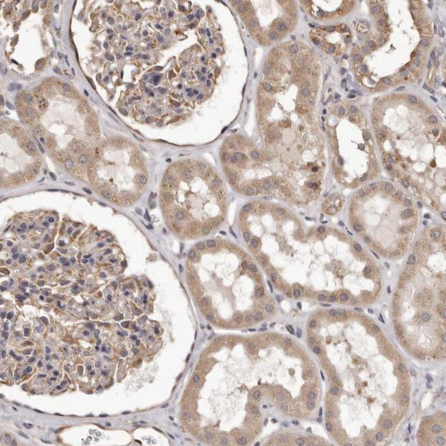 ALPK1 Antibody in Immunohistochemistry (IHC)