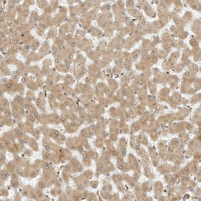 RC3H1 Antibody in Immunohistochemistry (IHC)