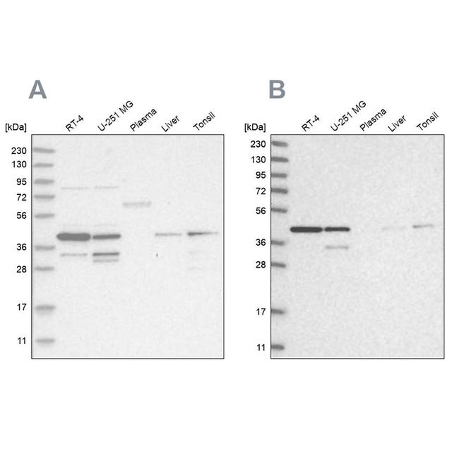 PPP1R8 Antibody in Western Blot (WB)