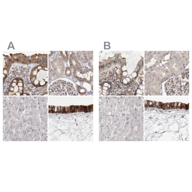 UFC1 Antibody in Immunohistochemistry (IHC)