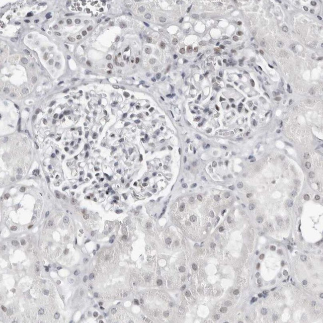 VEZF1 Antibody in Immunohistochemistry (IHC)