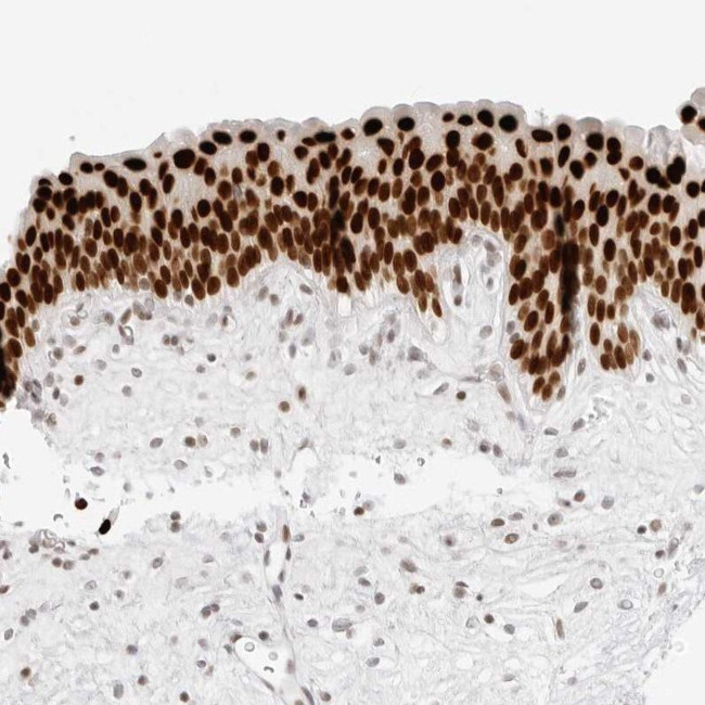 RCC1 Antibody in Immunohistochemistry (IHC)