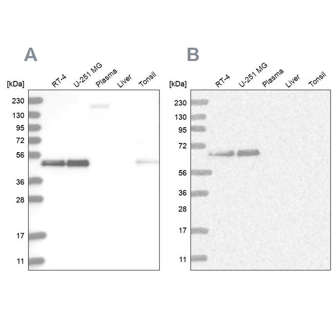 RCC1 Antibody in Western Blot (WB)