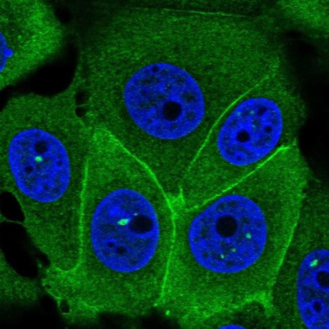 S100A14 Antibody in Immunocytochemistry (ICC/IF)