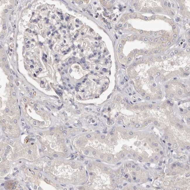 S100A14 Antibody in Immunohistochemistry (IHC)