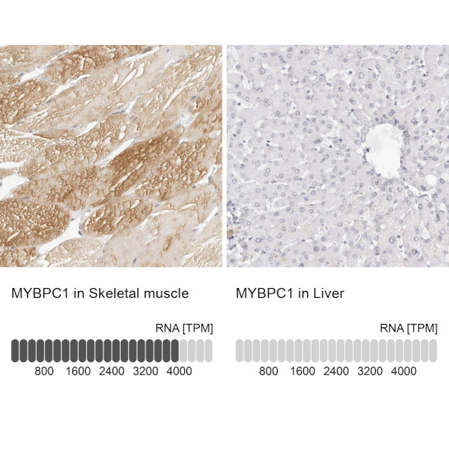 MYBPC1 Antibody in Immunohistochemistry (IHC)