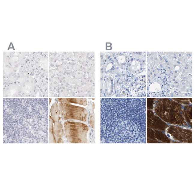 MYBPC1 Antibody in Immunohistochemistry (IHC)