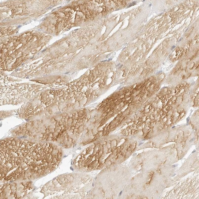 MYBPC1 Antibody in Immunohistochemistry (IHC)