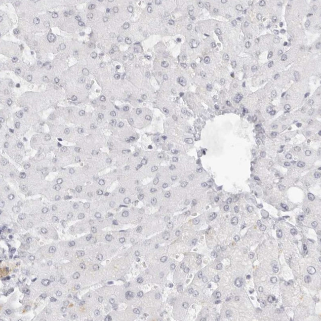 MYBPC1 Antibody in Immunohistochemistry (IHC)