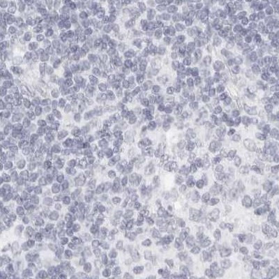 MYBPC1 Antibody in Immunohistochemistry (IHC)