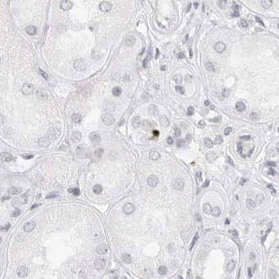 MYBPC1 Antibody in Immunohistochemistry (IHC)