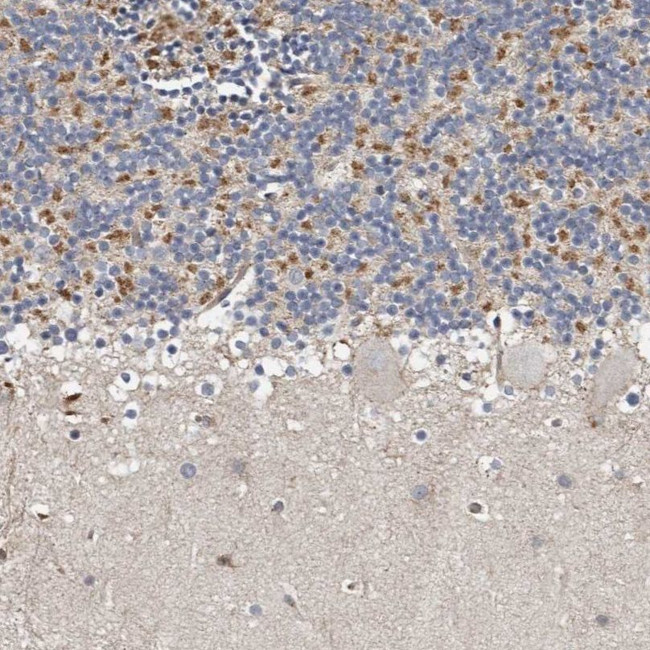 KIF26B Antibody in Immunohistochemistry (IHC)