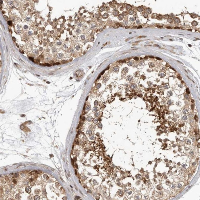 RABIF Antibody in Immunohistochemistry (IHC)