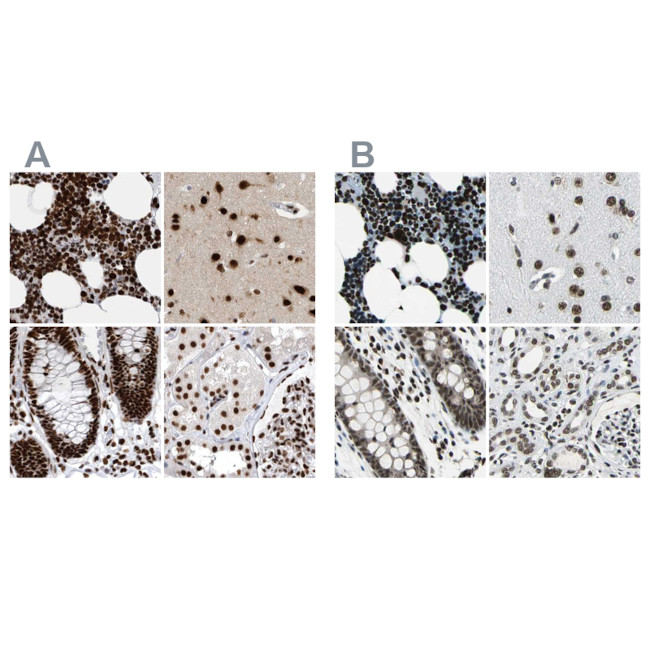 BCLAF1 Antibody in Immunohistochemistry (IHC)