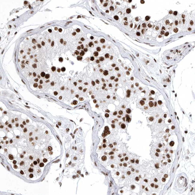 BCLAF1 Antibody in Immunohistochemistry (IHC)