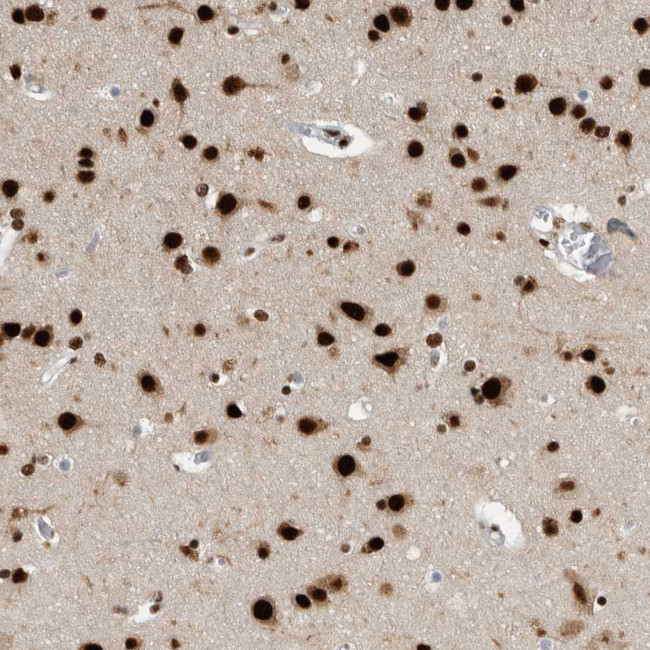 BCLAF1 Antibody in Immunohistochemistry (IHC)