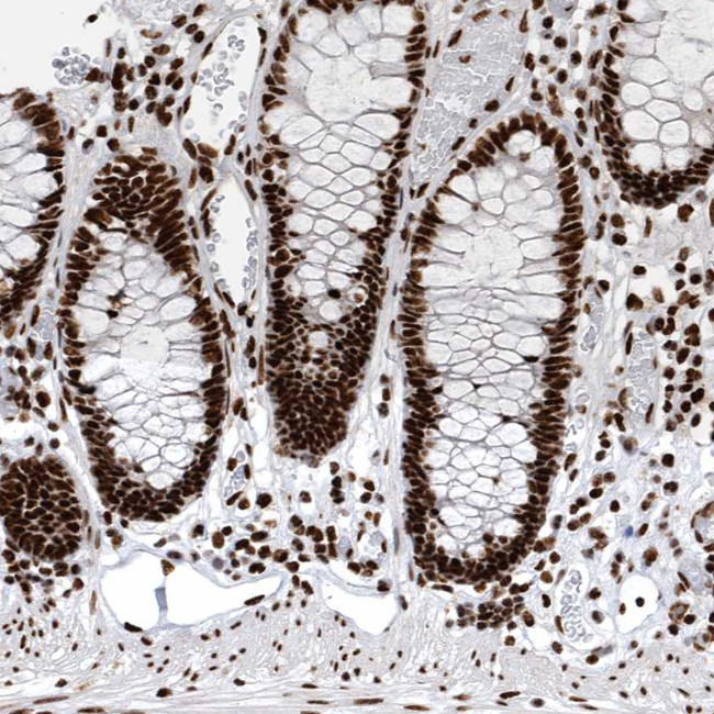 BCLAF1 Antibody in Immunohistochemistry (IHC)