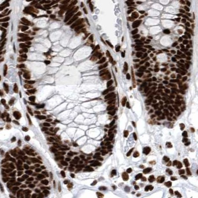 BCLAF1 Antibody in Immunohistochemistry (IHC)