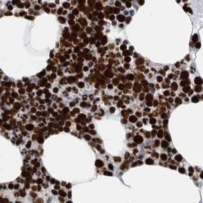 BCLAF1 Antibody in Immunohistochemistry (IHC)