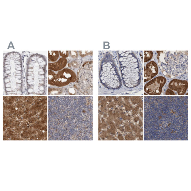 PNPO Antibody in Immunohistochemistry (IHC)