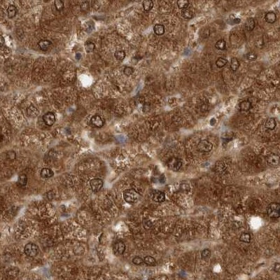 PNPO Antibody in Immunohistochemistry (IHC)