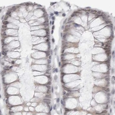 PNPO Antibody in Immunohistochemistry (IHC)