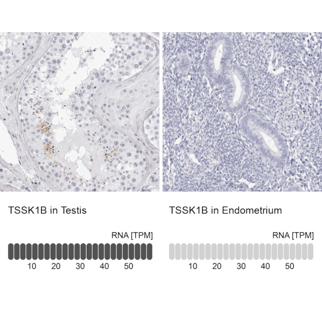 TSSK1 Antibody in Immunohistochemistry (IHC)