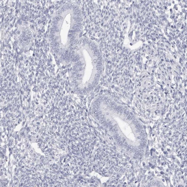 TSSK1 Antibody in Immunohistochemistry (IHC)