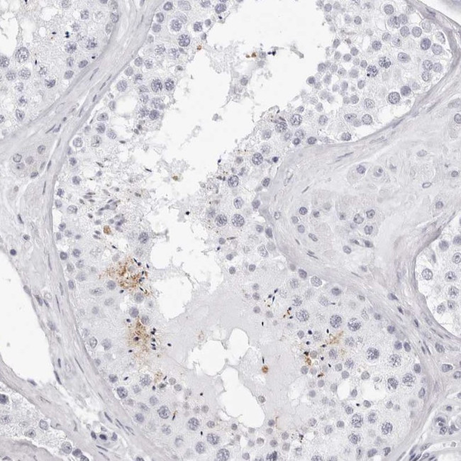 TSSK1 Antibody in Immunohistochemistry (IHC)