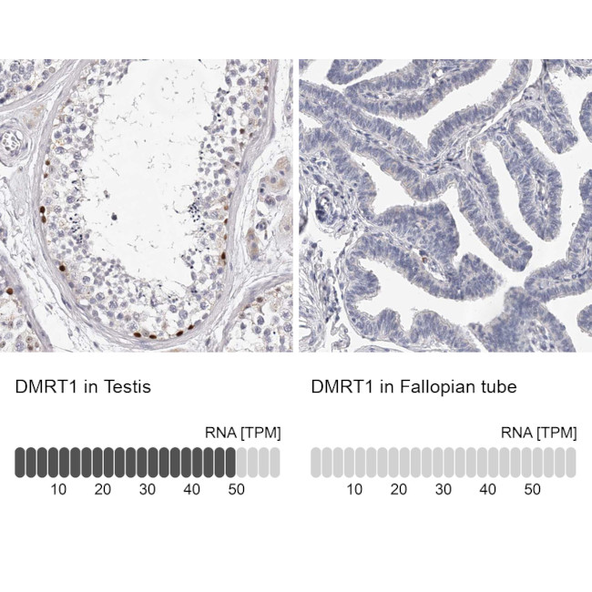 DMRT1 Antibody in Immunohistochemistry (IHC)