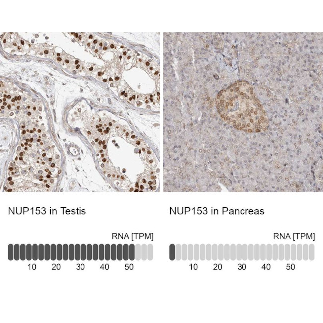 NUP153 Antibody in Immunohistochemistry (IHC)